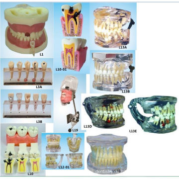 Mündliche Wissenschaft Ausbildung Ausrüstung Wurzel Kanal Abfüllung Modell Dental Teeth Modell